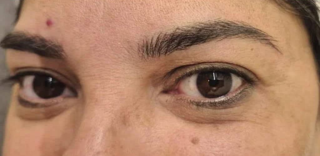 Depois — sobrancelha mais densa e simétrica após micropigmentação