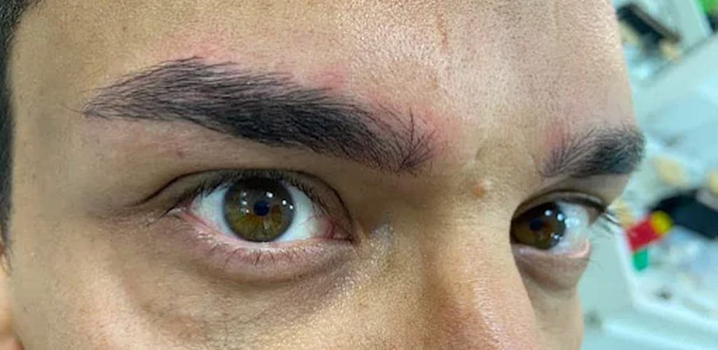 Depois — sobrancelha preenchida com nanoblading